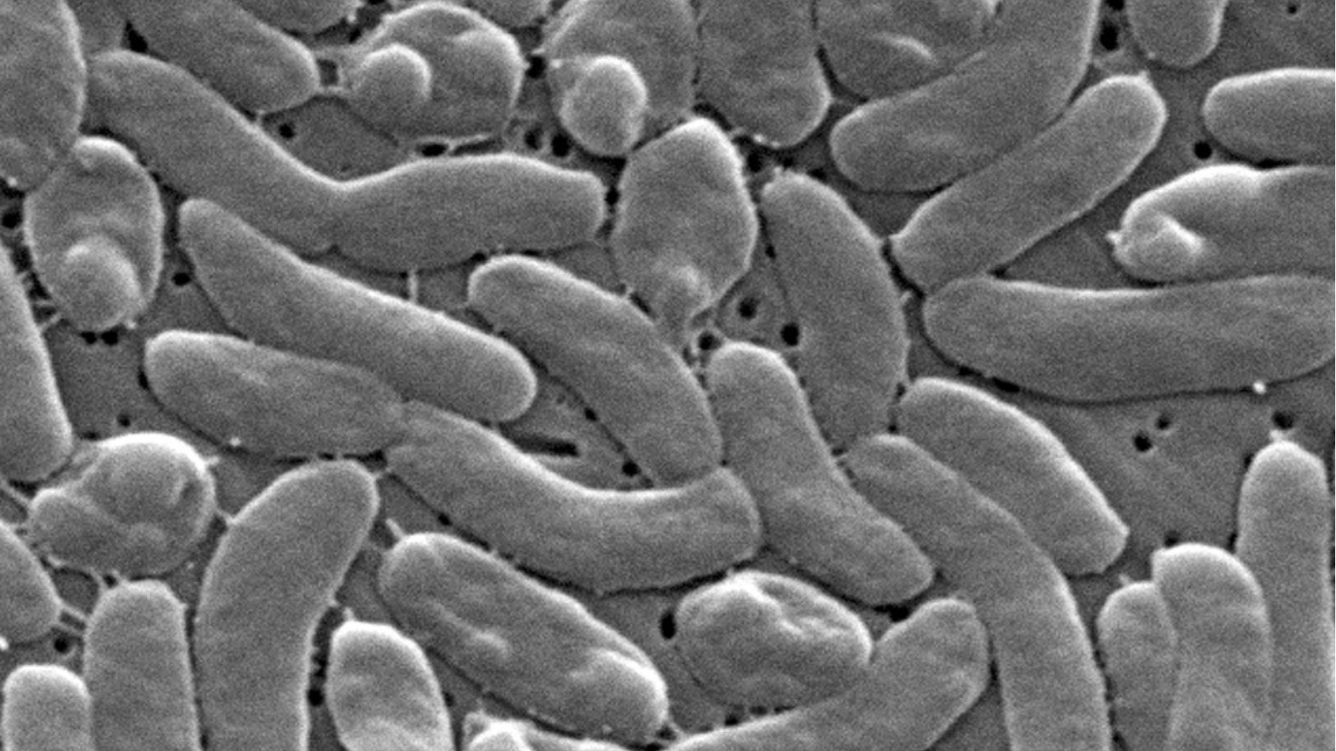 Health officials urging caution among Mississippi beachgoers amid 'flesh-eating' bacteria outbreak - SuperTalk Mississippi