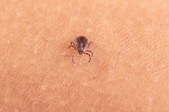 An adult female Asian longhorned tick, Haemaphysalis longicornis, crawling on a person’s skin.